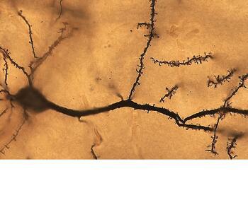 Photograph of a dark-shaded neuron in the foreground against a yellow background